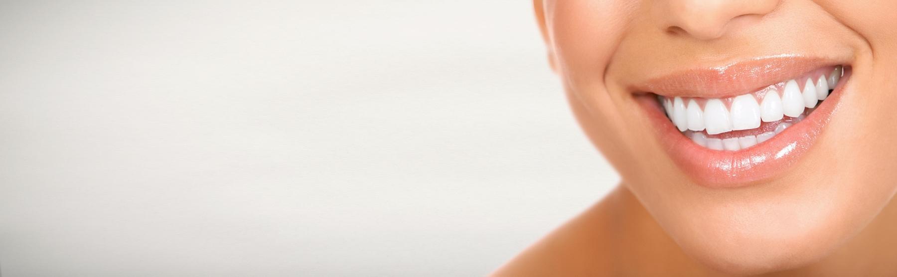 Close up of patients smile after teeth whitening in Norfolk, MA