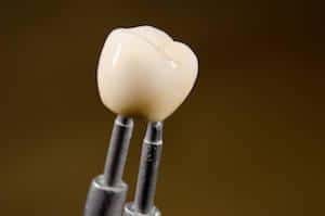 Close up of tool holding CEREC dental crown in Norfolk MA