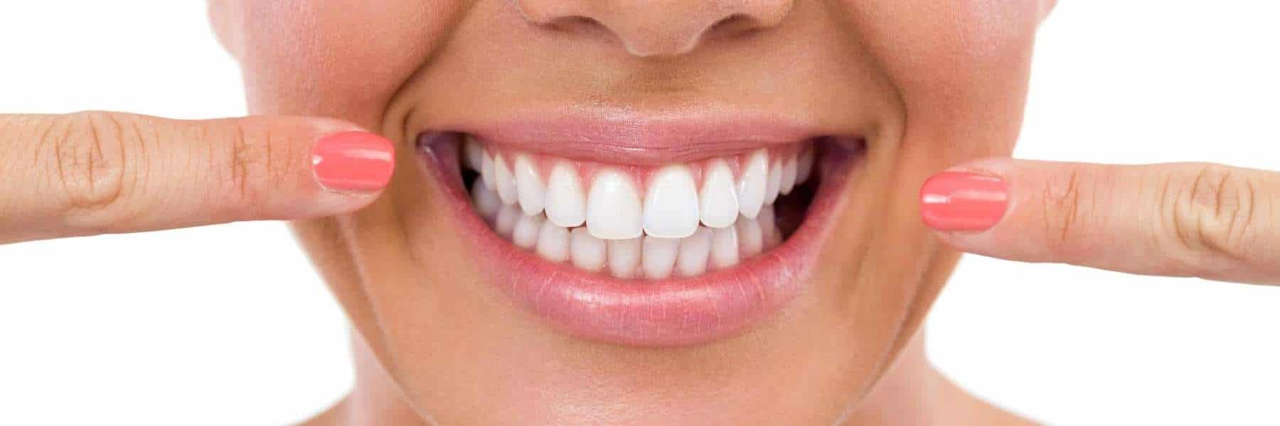 A smiling woman with perfect teeth