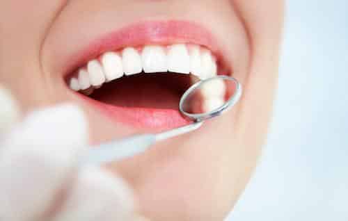 Close up of patients smile during dental exam in Norfolk MA