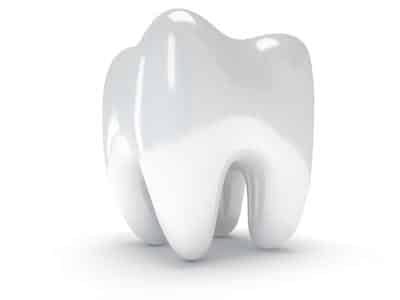 Digital graphic of enlarged tooth
