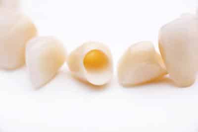 Close up of same day dental crowns at Norfolk County Dental Care