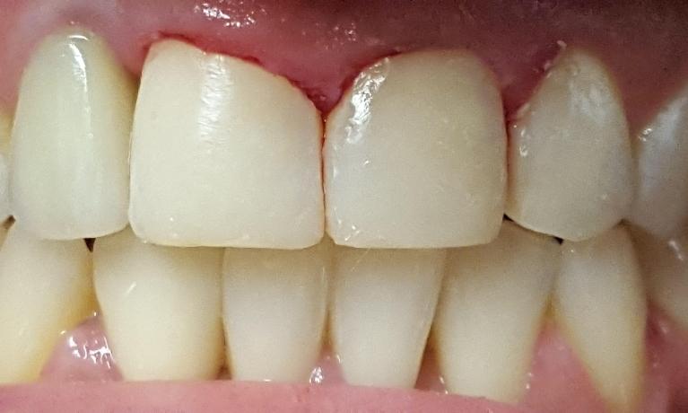 After Image: General Dentistry - front
