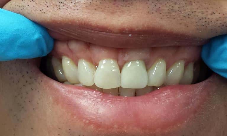 After Image: Cosmetic Dentistry - front