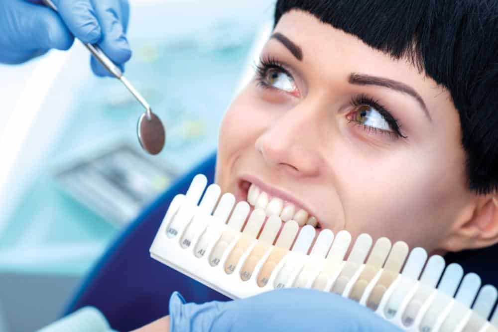 Teeth-Whitening2